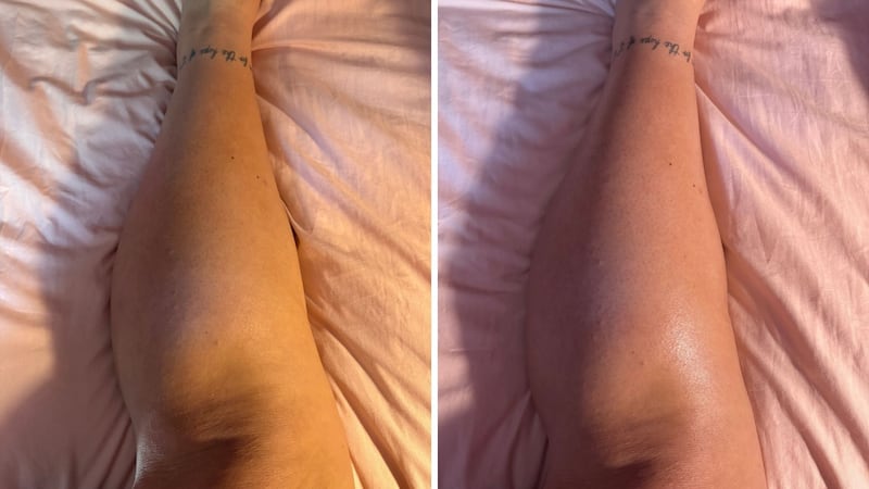 Bianca's leg before and after applying the moisturizer
