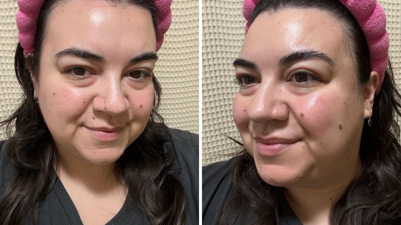 Bianca before applying the face mask (left). Bianca's skin immediately after peeling the mask off, revealing hydrated, glowy, and bouncy skin (right).