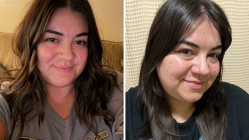 Bianca before and after using the toner for months