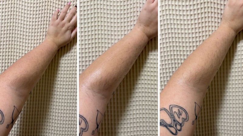 three images showing Bianca's dry arm before putting the cream on, her moisturized arm after putting the cream on, and her skin still moisturized 24 hours later