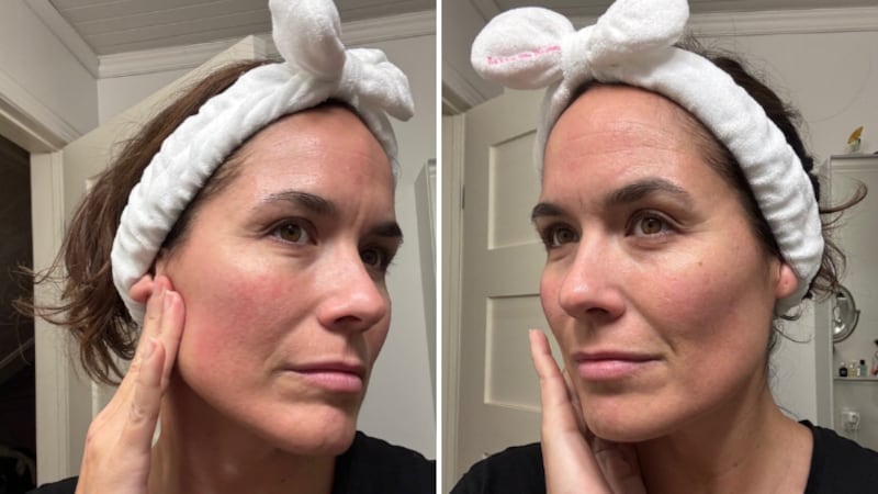 Valérie Sardin showing her skin after using the exfoliant tool