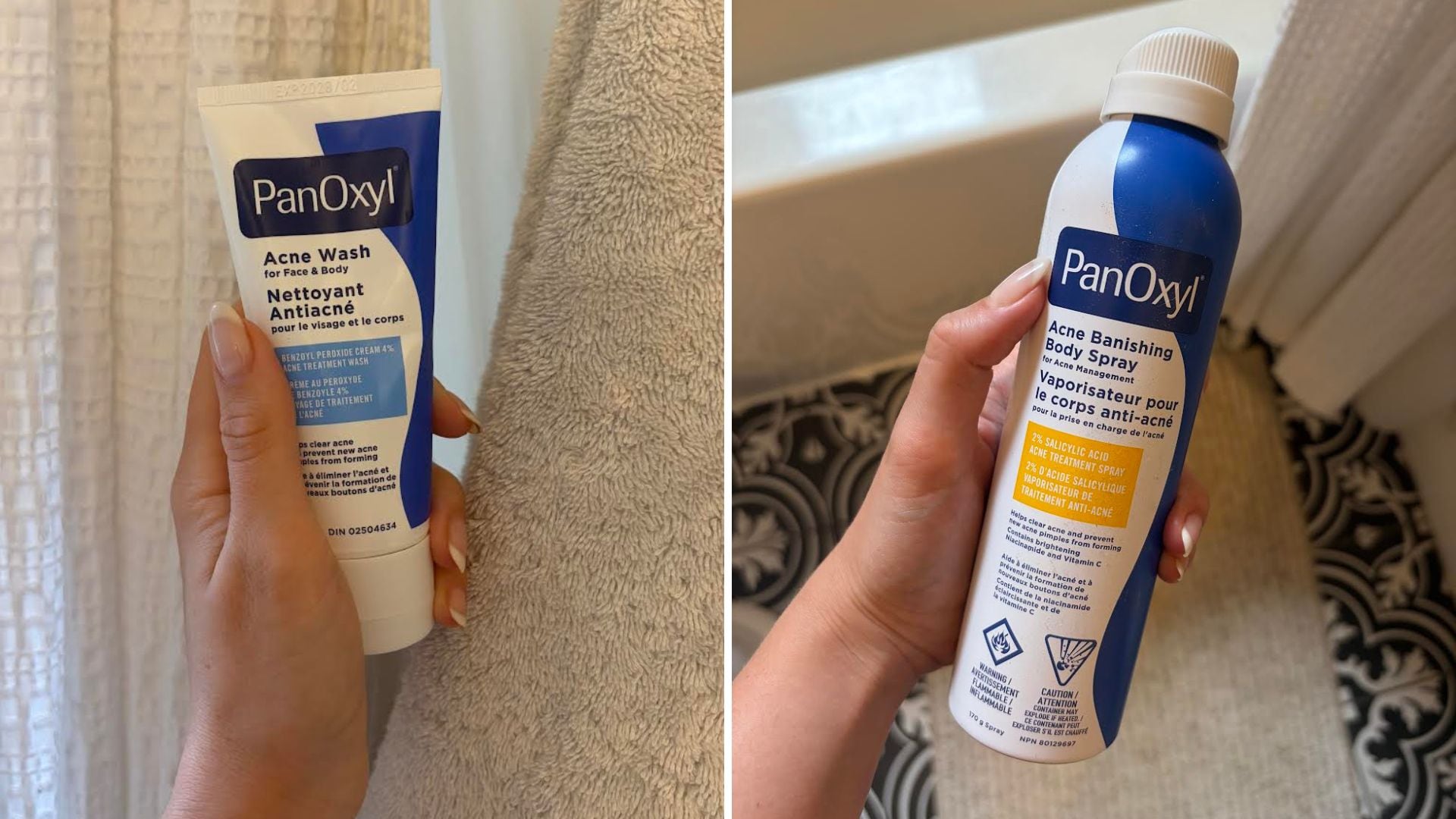 Alice Prendergast is holding a tube of PanOxyl body wash and a bottle of acne-fighting spray.