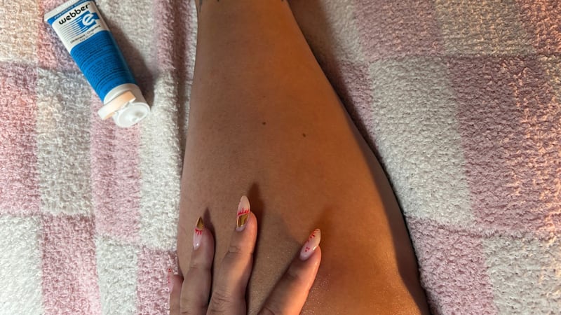 Bianca applying the ointment to a healing wound on her leg