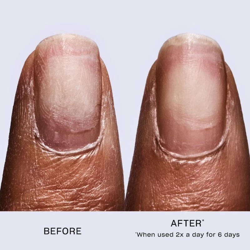 A person showing their nail before and after using the OPI Repair Mode serum.