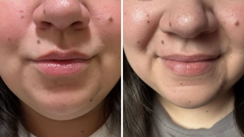 a before and after image of dry lips and moisturized plump lips
